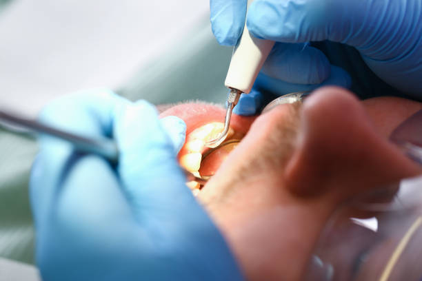 Best Knocked-Out Tooth Emergency  in Ray City, GA
