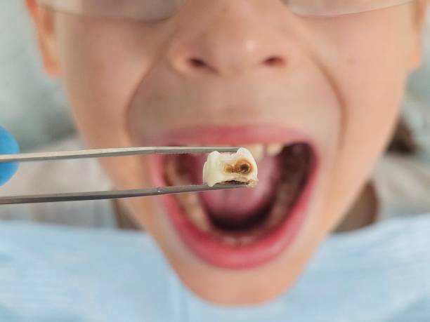 Emergency Dentist for Kids in GA